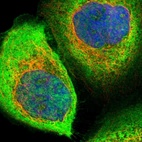 Immunofluorescent staining of human cell line A-431 shows localization to plasma membrane & cytosol.