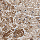 Immunohistochemical staining of human heart muscle shows moderate cytoplasmic positivity in myocytes.