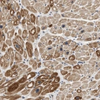 Immunohistochemical staining of human heart muscle shows moderate cytoplasmic positivity in myocytes.