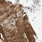 Immunohistochemical staining of human skeletal muscle shows moderate cytoplasmic positivity in myocytes.