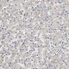 Immunohistochemical staining of human liver shows no cytoplasmic positivity in hepatocytes as expected.