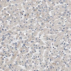 Immunohistochemical staining of human liver shows no cytoplasmic positivity in hepatocytes as expected.
