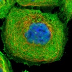Immunofluorescent staining of human cell line A-431 shows localization to nuclear bodies, plasma membrane & cytosol.