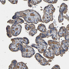 Anti-HTRA3 Antibody