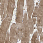 Immunohistochemical staining of human skeletal muscle shows moderate cytoplasmic positivity in myocytes.