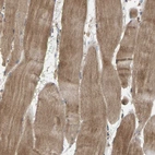 Immunohistochemical staining of human skeletal muscle shows moderate cytoplasmic positivity in myocytes.