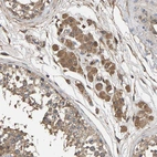 Immunohistochemical staining of human testis shows moderate cytoplasmic positivity in Leydig cells.