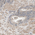 Anti-HTRA3 Antibody