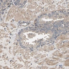 Immunohistochemical staining of human prostate shows weak to moderate cytoplasmic positivity in smooth muscle cells.