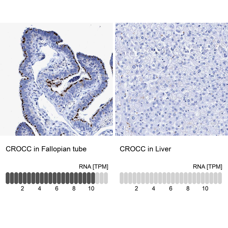 Anti-CROCC Antibody