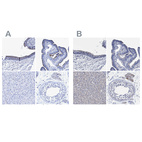 Immunohistochemical staining of human bronchus, fallopian tube, liver and testis using Anti-CROCC antibody HPA021191 (A) shows similar protein distribution across tissues to independent antibody HPA021762 (B).