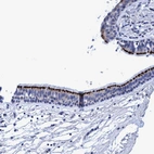 Immunohistochemical staining of human bronchus shows strong positivity in apical membrane in respiratory epithelial cells.
