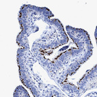 Immunohistochemical staining of human Fallopian tube shows strong membranous positivity in glandular cells.
