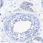 Immunohistochemical staining of human testis shows very weak cytoplasmic positivity in Leydig cells.