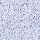 Immunohistochemical staining of human liver shows no positivity in hepatocytes as expected.