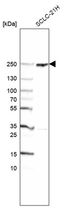 Western blot analysis in human cell line SCLC-21H.