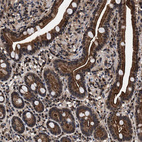 Immunohistochemical staining of human duodenum shows strong cytoplasmic positivity in glandular cells.