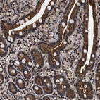 Immunohistochemical staining of human duodenum shows strong cytoplasmic positivity in glandular cells.