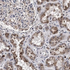 Immunohistochemical staining of human kidney shows moderate granular cytoplasmic positivity in cells in tubules.