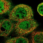 Immunofluorescent staining of human cell line A-431 shows localization to nucleoplasm, plasma membrane & vesicles.