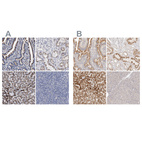 Anti-ACOX1 Antibody