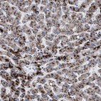 Immunohistochemical staining of human liver shows strong granular cytoplasmic positivity in hepatocytes.