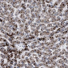 Immunohistochemical staining of human liver shows strong granular cytoplasmic positivity in hepatocytes.
