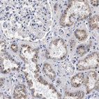 Immunohistochemical staining of human kidney shows moderate granular cytoplasmic positivity in cells in tubules.