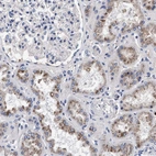 Immunohistochemical staining of human kidney shows moderate granular cytoplasmic positivity in cells in tubules.