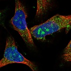Immunofluorescent staining of human cell line U-2 OS shows localization to nucleoli & vesicles.