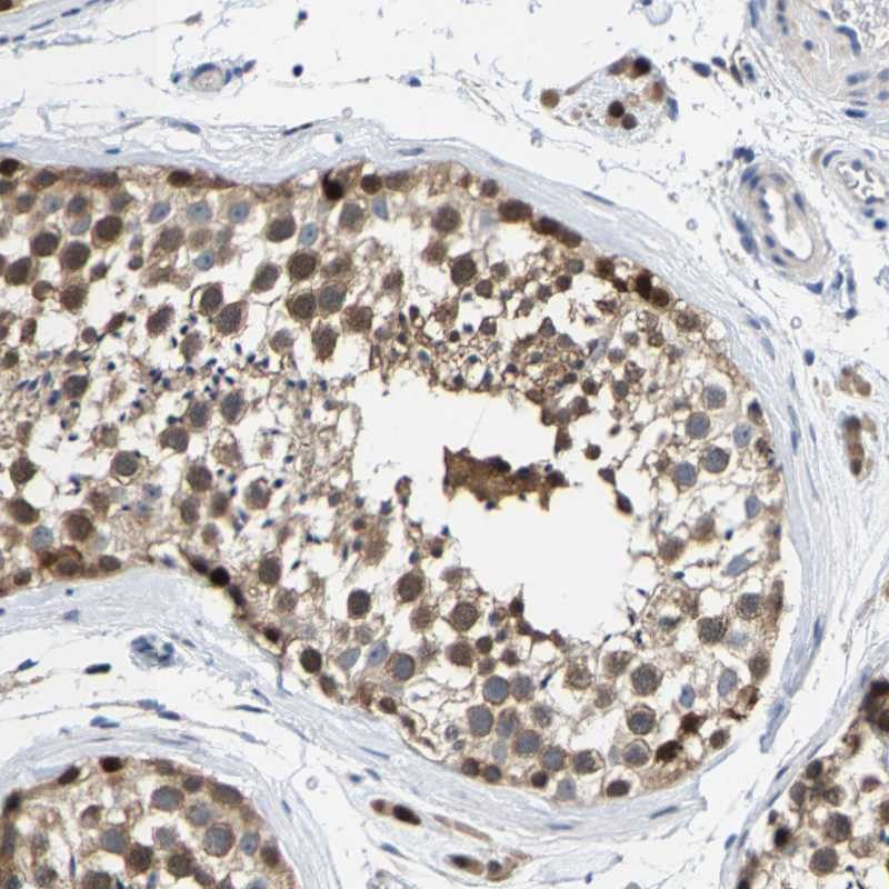 Anti-KLHL1 Antibody