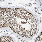 Anti-KLHL1 Antibody