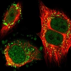 Immunofluorescent staining of human cell line U-251 MG shows localization to nucleoplasm & vesicles.