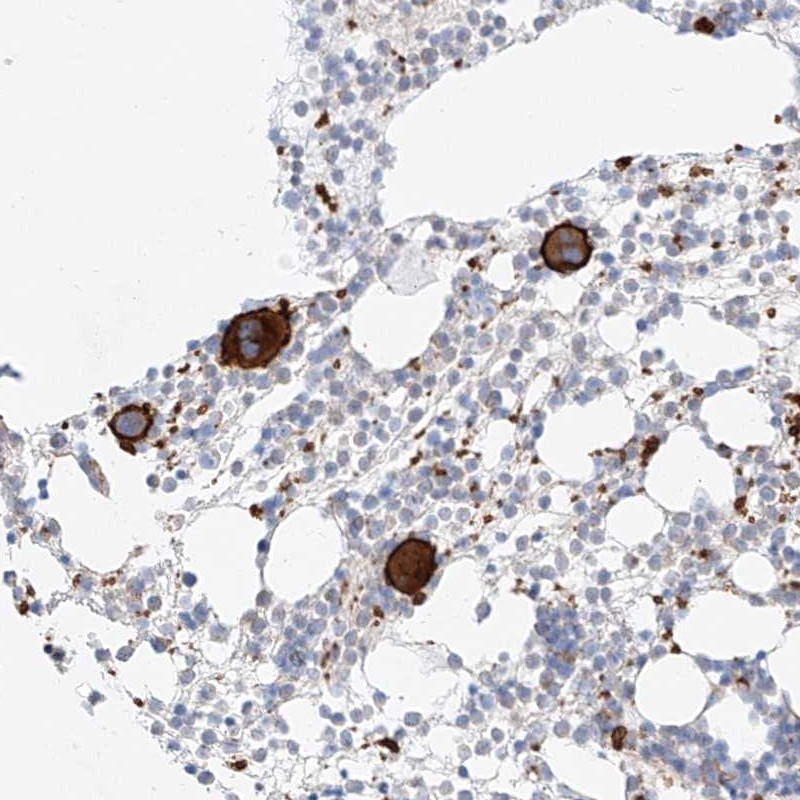 Anti-C9orf172 Antibody
