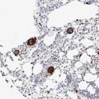 Anti-C9orf172 Antibody