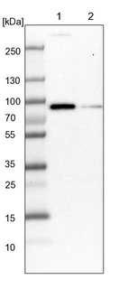 Lane 1: NIH-3T3 cell lysate (Mouse embryonic fibroblast cells)_br/_Lane 2: NBT-II cell lysate (Rat Wistar bladder tumour cells)