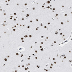 Anti-SMARCC2 Antibody