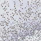 Immunohistochemical staining of human cervix, uterine shows strong nuclear positivity in squamous epithelial cells.