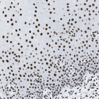 Immunohistochemical staining of human cervix, uterine shows strong nuclear positivity in squamous epithelial cells.