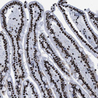 Immunohistochemical staining of human duodenum shows strong nuclear positivity in glandular cells.
