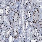 Immunohistochemical staining of human kidney shows strong nuclear positivity in cells in tubules.
