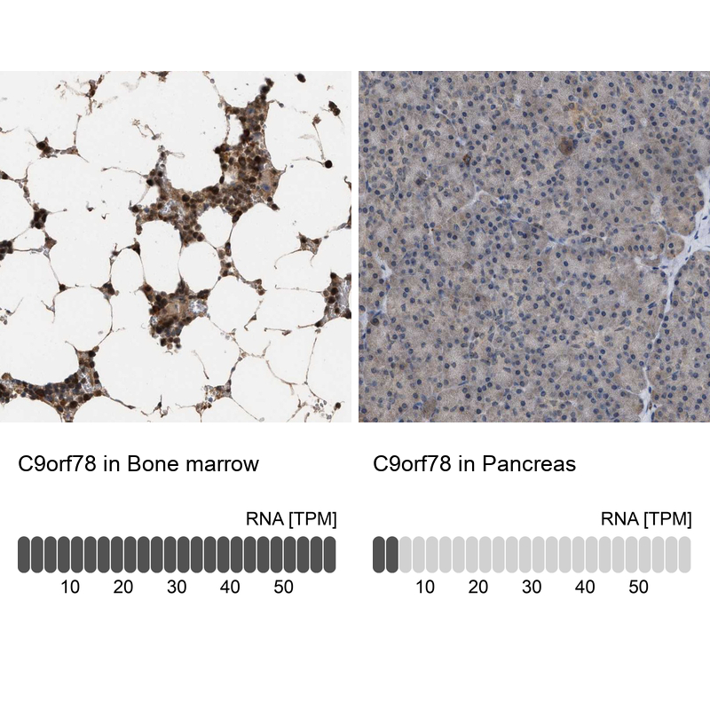 Anti-C9orf78 Antibody