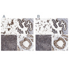 Immunohistochemical staining of human bone marrow, fallopian tube, lymph node and testis using Anti-C9orf78 antibody HPA021216 (A) shows similar protein distribution across tissues to independent antibody HPA021232 (B).