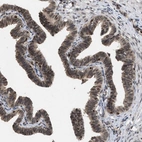 Immunohistochemical staining of human Fallopian tube shows moderate nuclear positivity in glandular cells.
