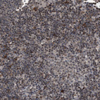 Immunohistochemical staining of human lymph node shows strong nuclear positivity in non-germinal center cells.