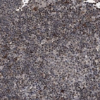 Immunohistochemical staining of human lymph node shows strong nuclear positivity in non-germinal center cells.