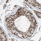 Immunohistochemical staining of human testis shows strong nuclear positivity in cells in seminiferous ducts.