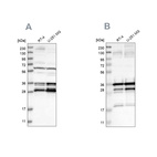 Western blot analysis using Anti-C9orf78 antibody HPA021216 (A) shows similar pattern to independent antibody HPA021242 (B).
