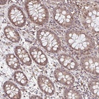 Anti-NUB1 Antibody