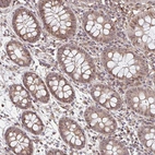 Anti-NUB1 Antibody